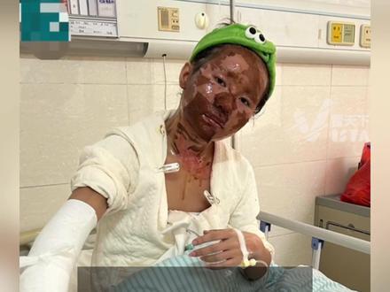 被伪装快递盒炸伤女主播发声:嫌疑人放易燃物时疑戴面具。被其骚扰两年,总共见过三次“主播并不低人一等,拒绝受害者有罪论。”