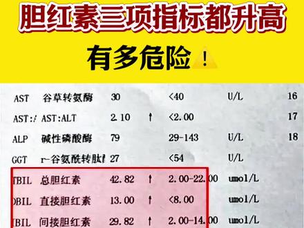 如果出现胆红素三项都高的情况,一般是比较可怕的,患者需要引起重视。
胆红素包括总胆红素、直接胆红素、间接胆红素,如果这三项都检测到偏高,是比较严重的,可能是身体出现胆道闭锁、胆石症等肝胆疾病,或者发生自身免疫性溶血性贫血、遗传性球形红细胞增多症等血液疾病引起的。
如果间接胆红素过高,可能是红细胞受到大规模的破坏引起的,肝脏的摄取和转化能力无法调节,一般是发生了蚕豆病、遗传性球形红细胞增多症等溶血性疾病。
总胆红素是直接胆红素和间接胆红素共同组成的,引起该物质异常的原因一般是因为患有肝细胞性黄疸、先天性家族性非溶血性黄疸等疾病。如果胆红素任何一项出现异常,还是三项都出现异常,患者都需要引起重视。#健康科普 #内容启发搜索 #肝病 #胆红素 #干货分享