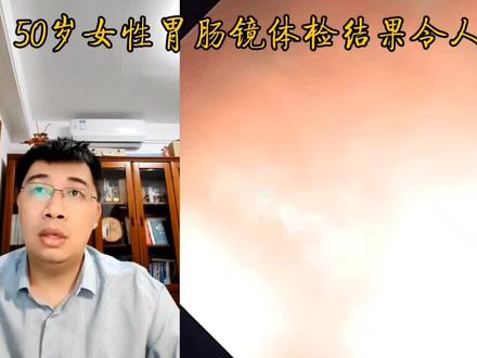 为什么要做胃肠镜?这么大病变都没有症状,只有胃肠镜可早诊早治 #明说鑫语 #消化青年论坛 #肠镜 #胃镜 #创作灵感