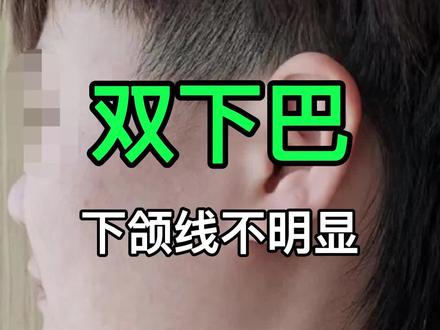130斤以下,还有双下巴、下颌线模糊,都不是因为胖 #双下巴 #体态纠正 #下颌线