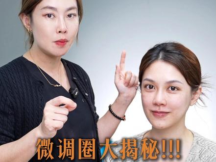 为什么别乱打眼周材料! #深圳注射 #注射导师 #杨芳 #眼周抗衰 #胶原蛋白填充
