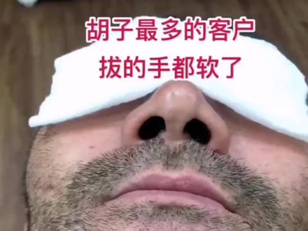 大哥痛吗?蜜蜡拔胡子真的很干净#深层毛孔清洁 #夏日 #男士 #胡须 拔的手都软了