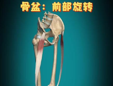 阔筋膜张肌(Tensor Fasciae Latae, TFL)的解剖与功能描述
1. 解剖位置与结构
位置:位于大腿前外侧,属于髋关节浅层肌肉。
起点:髂骨(髂前上棘及髂嵴前部)。
止点:通过髂胫束(Iliotibial Band, IT Band)延伸至胫骨外侧髁(Gerdy结节)。
形态:呈扁平三角形,长约15 cm,肌纤维向下后方走行,逐渐融入髂胫束。
2. 神经支配与血供
神经支配:臀上神经(L4-L5),与臀中肌、臀小肌共享神经来源。
血液供应:
主要:旋股外侧动脉升支
次要:臀上动脉分支
3. 功能
髋关节运动:
屈曲:协同髂腰肌使大腿前屈(如抬腿迈步)。
外展:与臀中肌共同维持骨盆稳定(单腿站立时防对侧骨盆下沉)。
内旋:辅助髋关节向内旋转(需与臀小肌协同)。
膝关节稳定:
通过髂胫束在步态周期中限制膝关节内翻(防止膝内侧过度受压)。
在足跟触地期(Heel Strike)缓冲胫骨外旋应力。
4. 临床关联
1. 髂胫束综合征(ITBS)
TFL过度紧张可导致髂胫束与股骨外侧髁摩擦,引发膝关节外侧疼痛(常见于长跑者)。
体征:Ober试验阳性(侧卧位髋外展受限)。
2. 代偿性功能障碍
臀中肌无力时,TFL常过度激活,导致“髋关节摇摆步态”及腰痛。
3. 手术标志
在髋关节前外侧入路(如全髋置换术)中,TFL与臀中肌间隙是重要分离平面。
4. 肌筋膜疼痛
触发点常位于髂前上棘下方2-3 cm处,可放射至大腿外侧及膝关节。
5. 运动与康复
强化训练:侧卧髋外展、蚌式开合(Clamshell)。
拉伸方法:
交叉腿站立,躯干向对侧屈(牵拉侧髋内收+后伸)。
泡沫轴放松髂胫束(需避免直接滚压股骨外侧髁)。
代偿预防:避免久坐导致的TFL缩短,需结合臀肌激活训练。
6. 影像学特征
超声:可动态观察TFL收缩时的厚度变化。
MRI:冠状位T1像清晰显示肌腹与髂胫束的连续关系。#阔筋膜张肌 #骨盆前倾 #髋关节置换