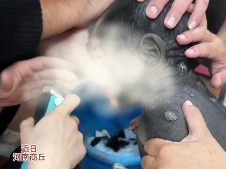 宝宝出生后满身“兽皮痣”,医生:无法预防需警惕癌变。