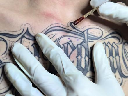 拍一期全程穿刺的过程~
#直角埋钉 #埋钉 #穿孔