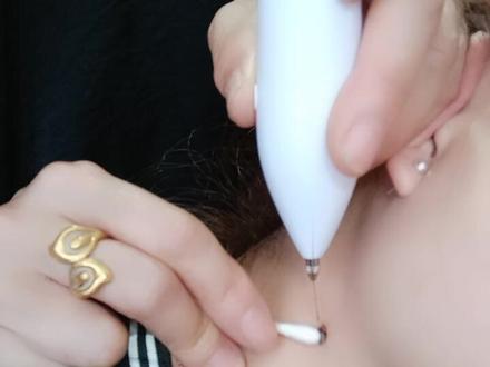 很多女人脖子上都会长痣,女人颈部不同位置的痣相代表不同的运势:旺夫 苦情 劳碌 行路 ☠️相痣,你是哪一种