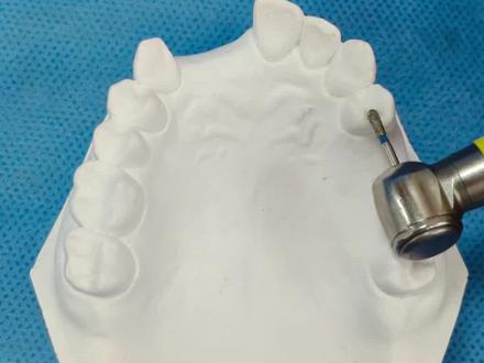 弯制颌支托、卡环#牙齿🦷 #口腔技师#可摘局部义齿