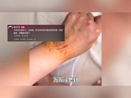 被鲨鱼咬伤事件后续?回国多天没看医生,伤口恶化可能感染截肢