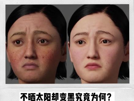 不晒太阳却变黑究竟为何?带你解密美容的真相之科学美白方法 #敏感肌 #先修后白 #美白 #薇诺娜修白瓶