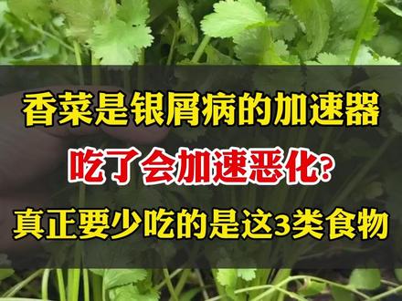 香菜是银屑病的加速器,吃了会加速恶化?真正要少吃的是这三类食 #银屑病 #中医 #牛皮癣