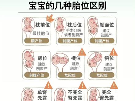 宝宝的几种胎位区别#新手爸妈 #孕期 #胎位