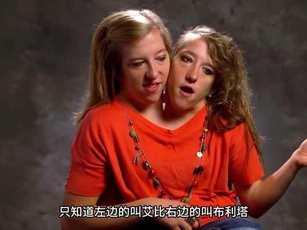 两个头共用一个身体的姐妹花,真是一个奇迹#国外生活