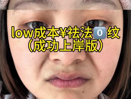 关于法令文说说我的个人经验,详细如下#真实生活分享计划 #化妆基础知识#女性必看#淡纹护理