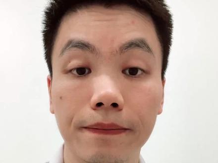 猪肉抗生素超标38倍,火腿肠还能吃吗?医生告诉你答案! #林可霉素 #双汇 #抖出健康知识宝藏