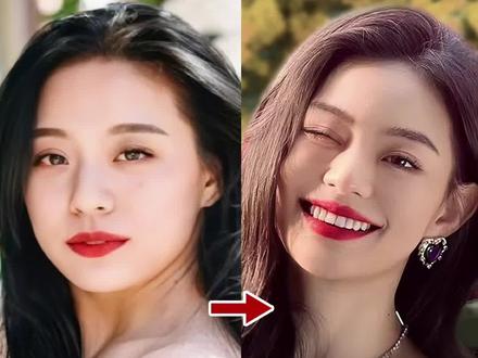 2次整牙的痛苦经历,我真的有效变美了吗?凸嘴、发腮、咬肌大、下巴后缩、深覆合…整牙都能改善吗?#整牙 #凸嘴#牙齿正畸#牙套