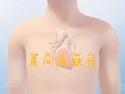 房间隔缺损是先天性心脏病中最常见的类型之一,儿童和成人可表现为乏力和活动后的气促,缺损较大的患儿可能会生长发育迟缓。
可行房间隔缺损封堵术或房间隔缺损修补术!