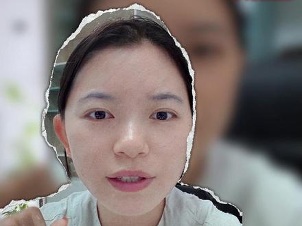 刚果金埃博拉已致100多人死亡,邻国乌干达、安哥拉也中招!美国已限制入境。
我在非洲5年,亲眼见过身边人感染暴毙。这次是本迪不交型,没有疫苗和特效药。
给在非洲打拼的同胞3条保命建议👇
①不要接触野生动物/当地生肉
②家里常备药物,不舒服马上去正规医院
③有基础病的,真的别来非洲
保命比赚钱重要,转发提醒你在非洲的朋友❗
#埃博拉 #刚果金 #非洲疫情 #非洲创业 #海外同胞注意