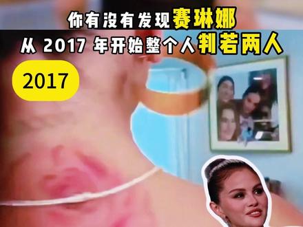 太诡异了!2017年后的赛琳娜好像换了个人 #赛琳娜 #赛琳娜戈麦斯 #换肾 #肾脏移植