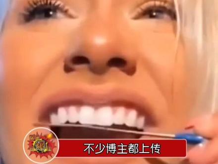 美容博主用指甲锉打磨牙齿,他们觉得这样能让牙齿更加整齐,不过牙医警告不要效仿,爱美也要用对方法