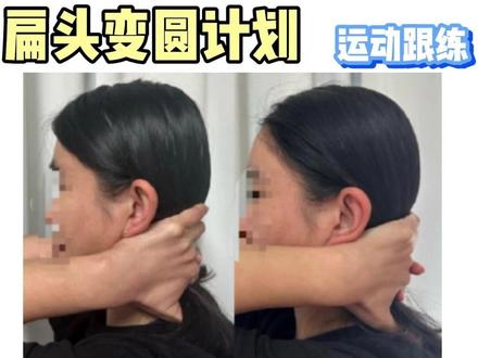 扁头变圆计划——动作跟练 #扁头 #头型 #扁头变圆头 #圆头