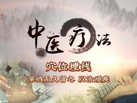 #穴位埋线,是#中医针灸和#埋线疗法融汇而成的一门新型学科。该疗法通过针具和药线,在穴位内产生长久刺激,从而达到治疗疾病的目的。 #广州白云 #中医疗法