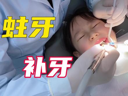 4岁孩子蛀牙疼痛难忍,第一次补牙全程超配合,医生亲授护牙秘诀 #萌娃 #蛀牙 #亲子 #补牙