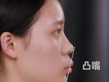 越凸越画?越画越凸?凸嘴女孩必看的硬核教程来啦#凸嘴#化妆教程