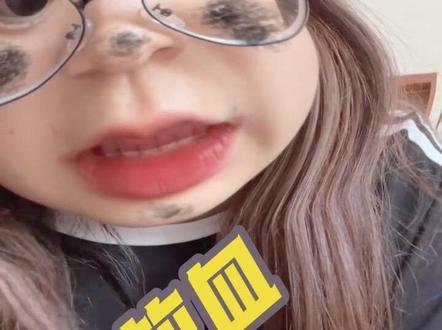 第二次放血~#原创视频 #vlog日常 #涨知识