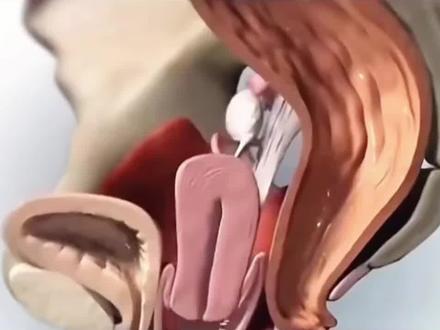 30➕40➕50➕女生一定要练八爪鱼训练#居家锻炼 #女生必看#盆底肌训练#产后恢复