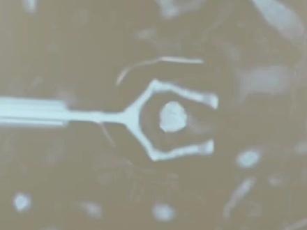 免开刀治肺结节?华西医院这项国际首创,能保95%以上的肺 #健康 #华西 #肺结节 #医学科普 #生命科学