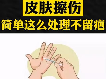 皮肤不小心擦伤了,很容易留下难看的疤痕,那怎么办不留疤痕呢?#伤疤 #疤痕