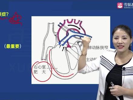 什么是法洛四联症#护士 #护师 #主管护师 #初级护师 #护考 @企业号课程助手 @企业号小助手