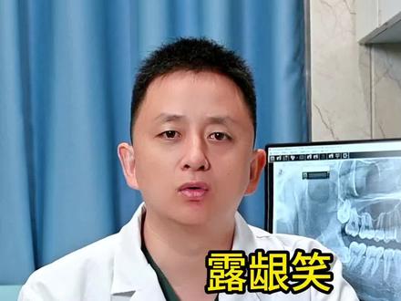 一笑就露出很多牙龈这叫露龈笑,影响美观,这种情况要怎么解决?#露龈笑 #牙齿 #正畸 #牙齿矫正 #牙医@抖音医疗健康小助手