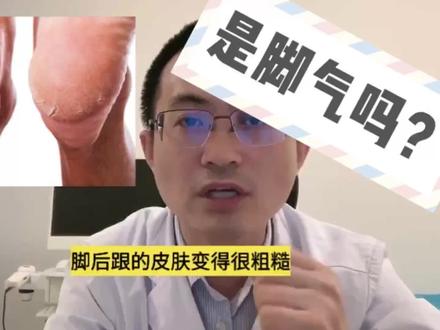 脚后跟干裂起硬皮,是脚气吗?@DOU+小助手