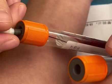 比熊猫血还稀有 全球仅两例,广西发现罕见血型“恐龙血”#社会