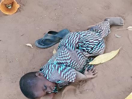 这俩娃刚割完包皮难受,非洲娃从小用刀片在家自己割包皮,