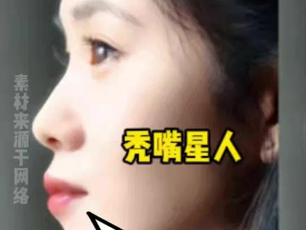 徐媛人中科普 #面部美学 #人中缩短 #变美
