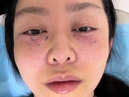 43岁苹果原相机无美颜,无滤镜前置镜头拍摄 #真实经验分享计划 #上个热门太难了 #记录自己 #抖音新人扶持#分享我的护肤经验