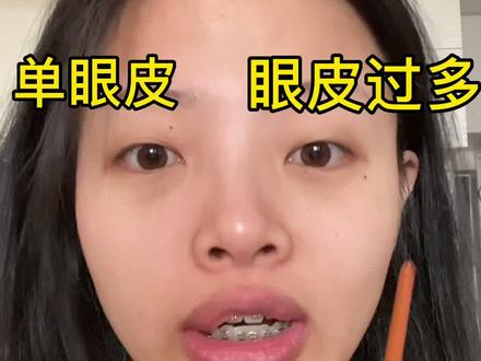 视频略长,但是觉得自己「眼睛无神」「眼皮松弛」「提肌无力」的一定看完#双眼皮贴教程