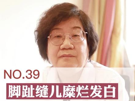 脚趾缝糜烂发白,又臭又痒怎么办?#医学科普 #科普健康知识 #医学知识科普