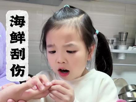 科普知识!关键时刻能救命 被海鲜刮伤,应该怎么处理呢?看完秒懂……#科普知识#正确引导教育孩子#家庭教育#涨知识#海鲜刮伤