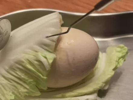 #智齿 冠周炎是怎么回事?怎么处理更好?#科普 #口腔科普 #医学科普 #爱牙日 #牙齿 #智齿疼 #拔智齿