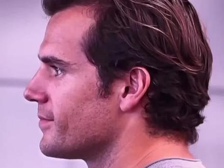 #p图 #修图 #黄金比例脸 #修图前vs修图后 #超人