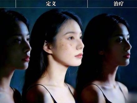 黄褐斑,皮肤科公认的“难搞”问题。今天教授用一个公式教你淡化#黄褐斑 #美白淡斑 #张教授的小课堂 #医学科普