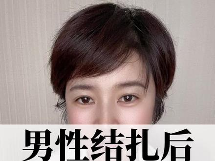 男X结扎后还可以复通吗?#健康科普 @抖音小助手