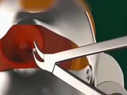 动画演示,无痛人流全过程!#女性健康 #关注女性健康 #月经