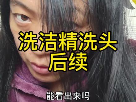 洗洁精洗头后续来了#去屑 #控油 #洗洁精