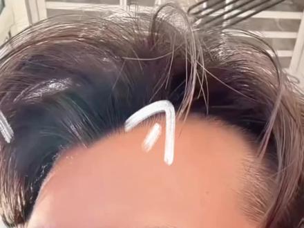 2.7狗总:金银涨势藏不住了 #狗总 #基金 #黄金