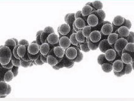 秋季要谨防三毛金藻#养鱼 #水产养殖