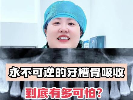 牙槽骨吸收是牙周炎的一个重要病理变化,由于牙槽骨的吸收,使牙齿的支持组织丧失,牙齿逐渐松动,最终脱落或拔除。#口腔健康 #健康守护计划 #牙周炎 #牙槽骨吸收 #牙齿松动